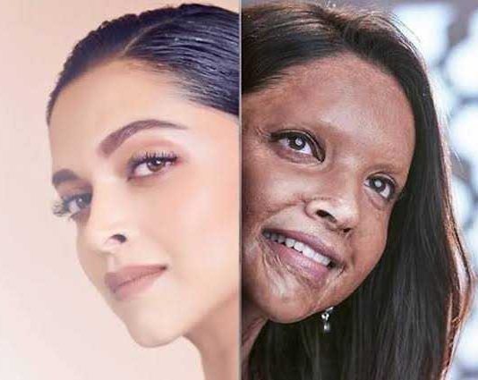 Chhapaak Movie Review In Hindi: ‘छपाक’ मूवी रिव्यू, दीपिका ने निभाया दमदार किरदार